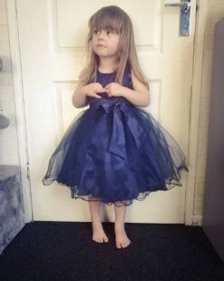 Kids Girls' Dress Solid Colored Flower Tulle Dress Wedding Party Layered Tulle Mesh Blue Red Fuchsia Knee-length Sleeveless Cute Dresses Summer 2-12 Years / Lace / Bow -Slay Clothing Shop 1b12f1dc 8f67 4fa1 bbf1 db2bba2caad1